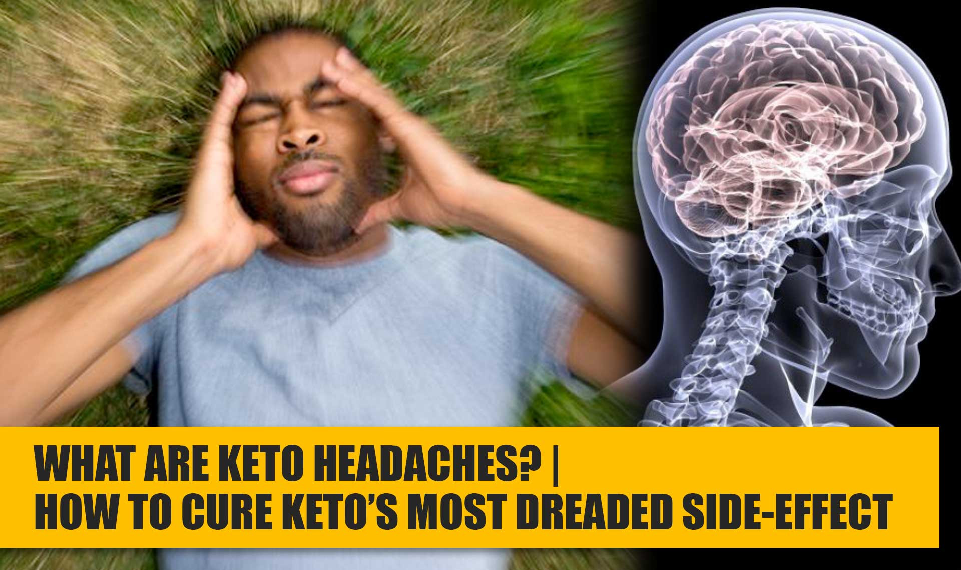 Keto Diet Migraines
 Keto Headache 4 Effective Ways to Get Rid of the Pain