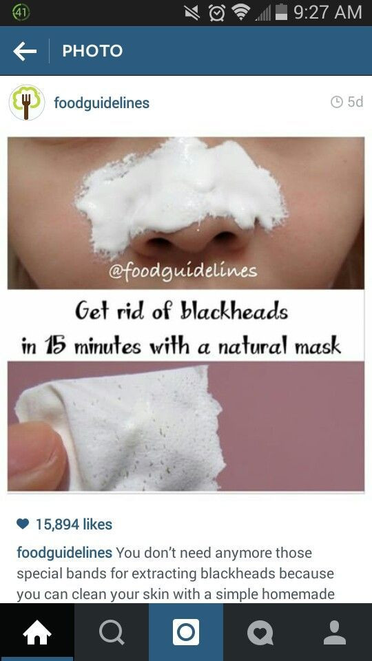 Best Face Mask For Blackhead Removal DIY
 Pin on Black Heads Cleansing Mask
