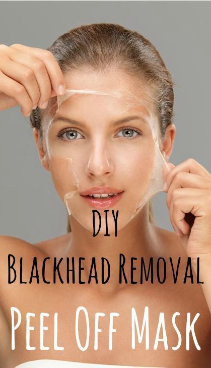 Best Face Mask For Blackhead Removal DIY
 Vingle Effective Blackhead Peel f Mask DIY Face Mask