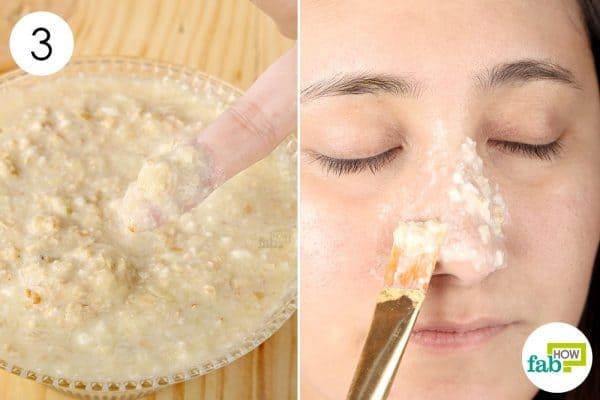 Best Face Mask For Blackhead Removal DIY
 9 DIY Face Masks to Remove Blackheads and Tighten Pores
