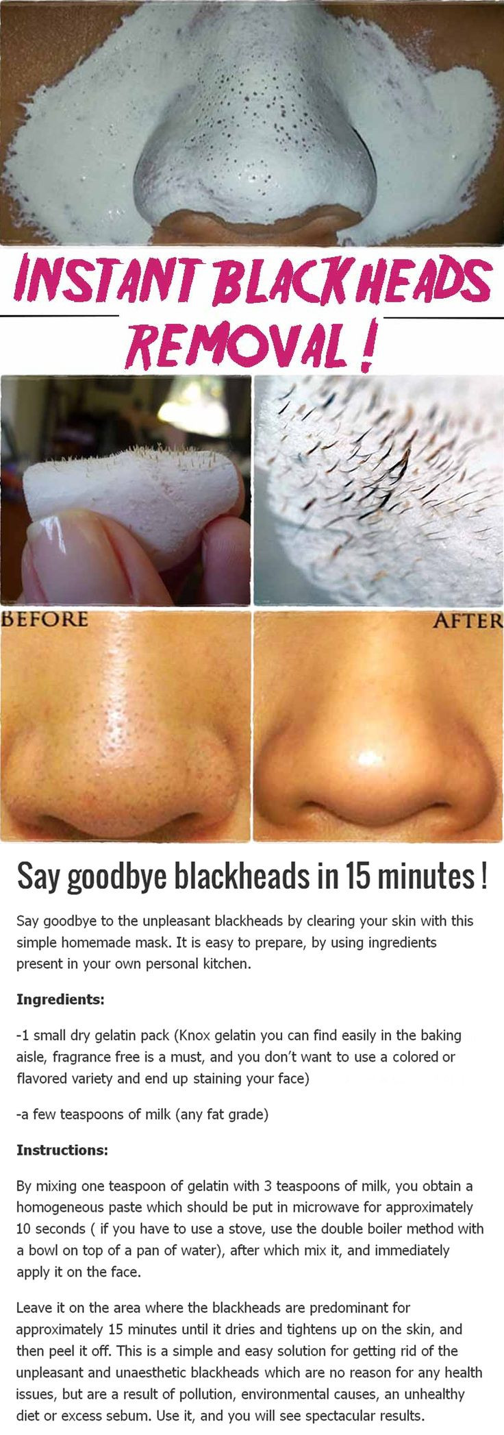 Best Face Mask For Blackhead Removal DIY
 De 25 bedste idéer inden for Blackhead remover på