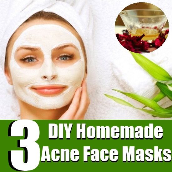 DIY Face Mask For Breakouts
 Top 3 DIY Homemade Acne Face Masks