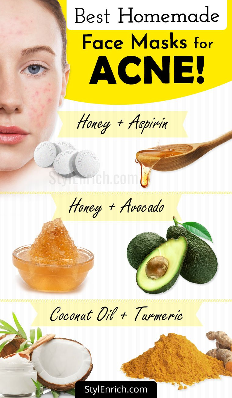 DIY Face Mask For Breakouts
 Homemade Face Mask For Acne Treatment At Home