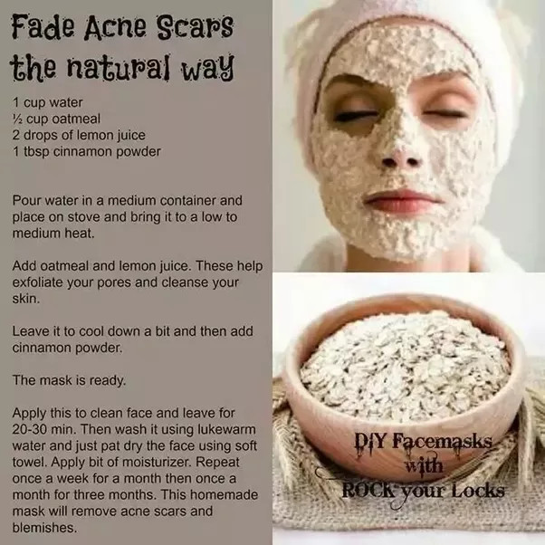 Easy DIY Face Mask For Acne
 What are the best DIY face masks for acne scars Quora