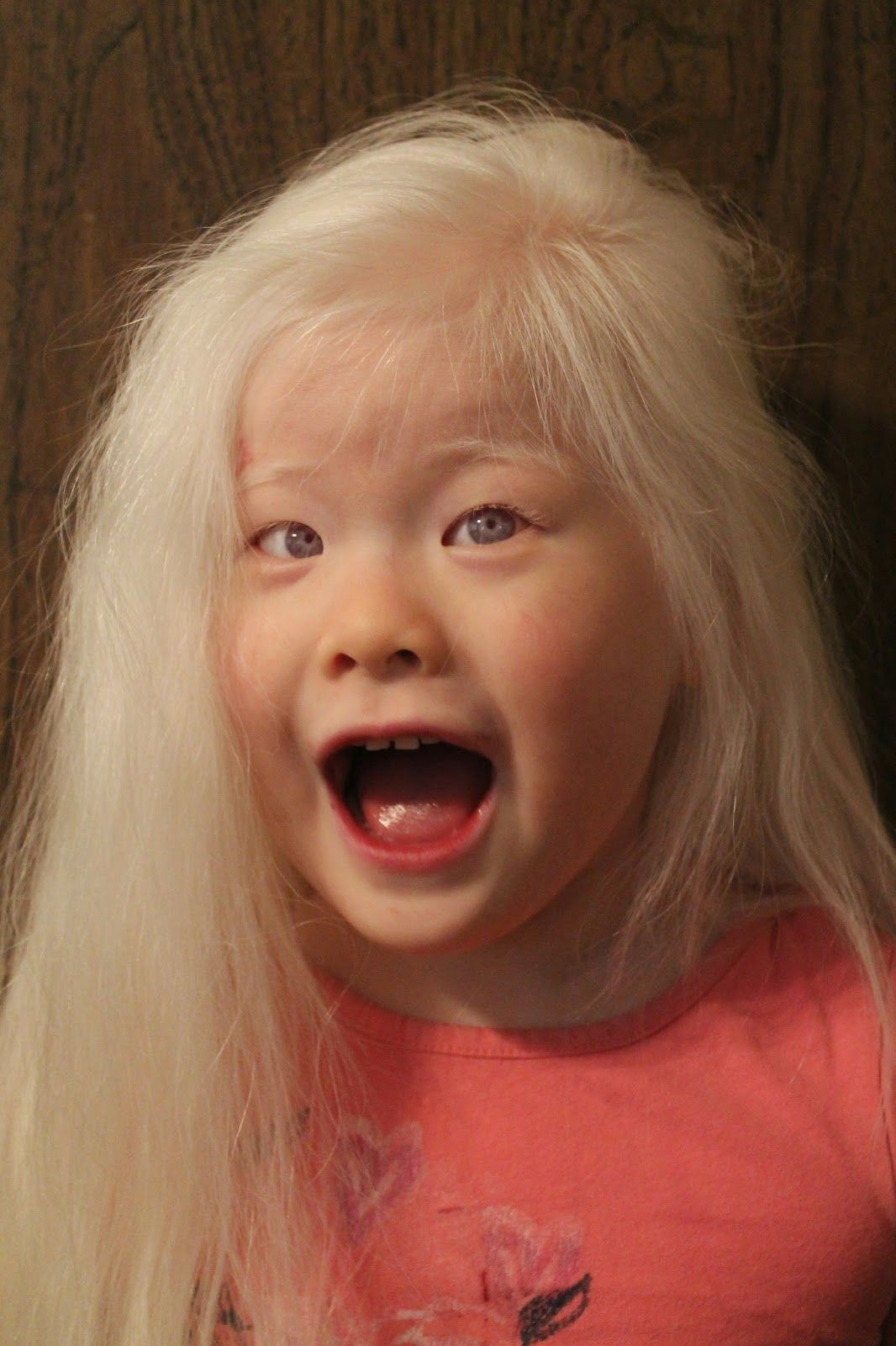 Kids With White Hair
 albino children white hair white eyelashes red eyes