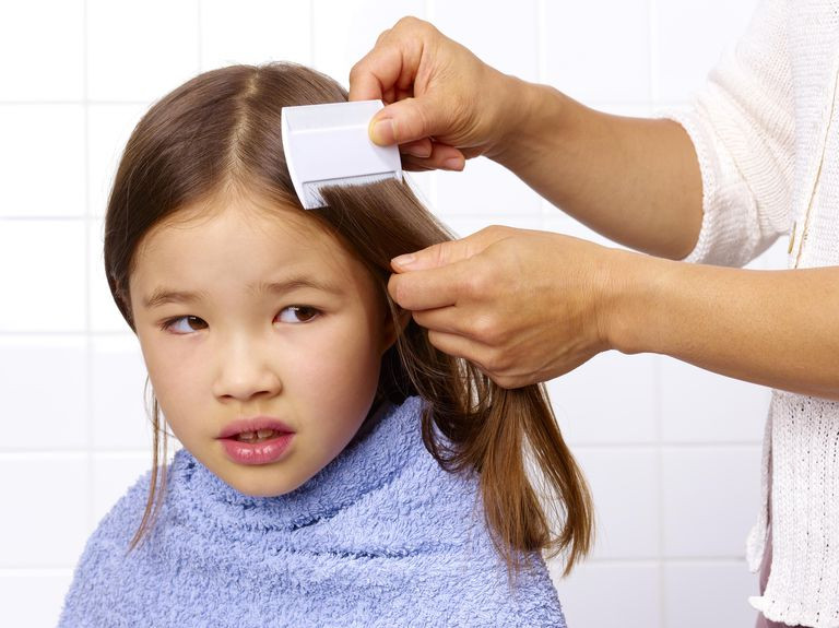 Lice In Baby Hair
 How to Find Head Lice in Your Child s Hair