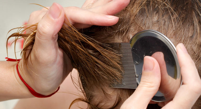Lice In Baby Hair
 How to tell if your child has head lice