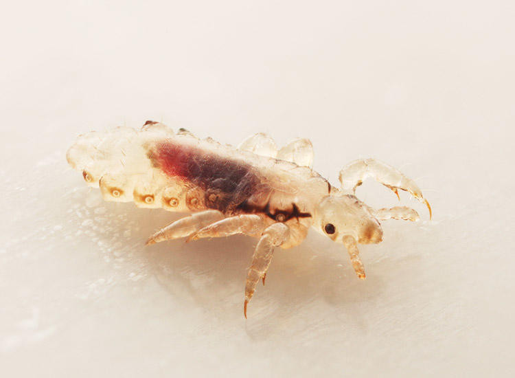 Lice In Baby Hair
 Head Lice 101 Symptoms Treatment & Prevention