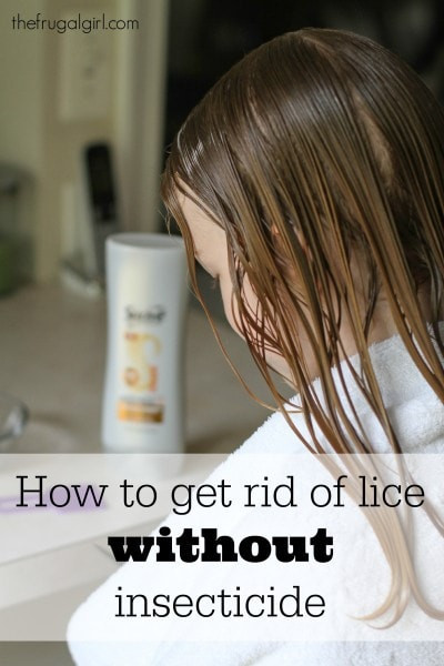 Lice In Baby Hair
 How to rid of lice with tea tree oil instead of