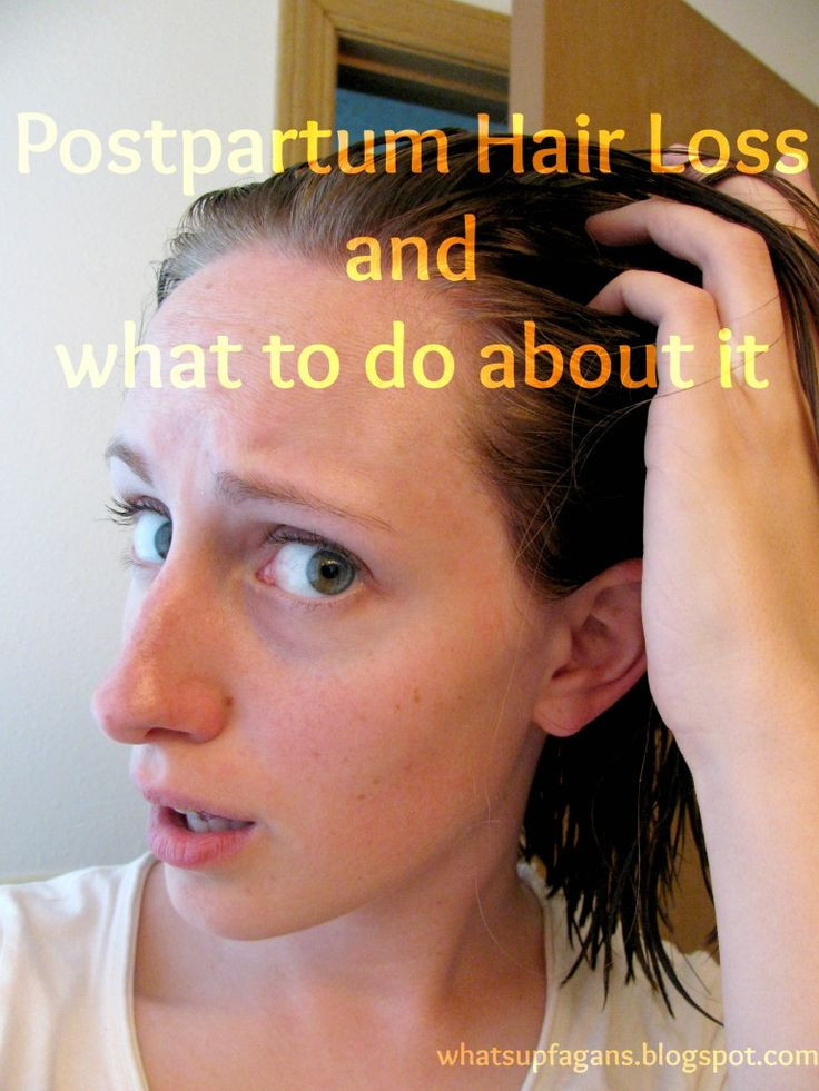 Post Baby Hair Loss
 Pin on teach Birth 12 months