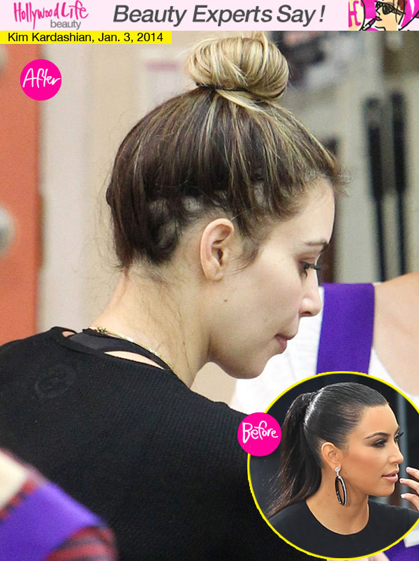 Post Baby Hair Loss
 Kim Kardashian’s Hair Loss — Is She Going Bald Post