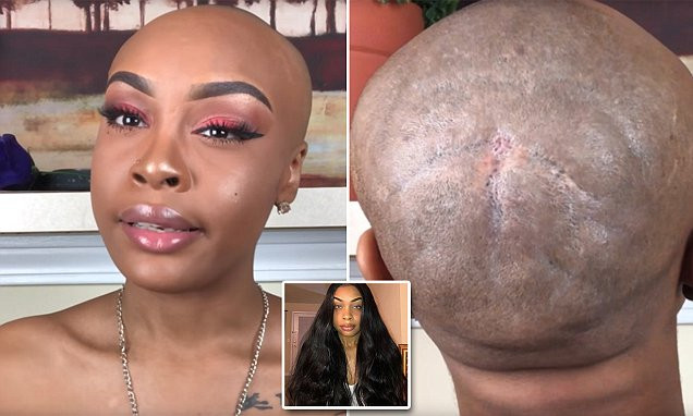 Shaving Baby Hair Good Or Bad
 Woman reveals how a bad weave forced her to shave her hair