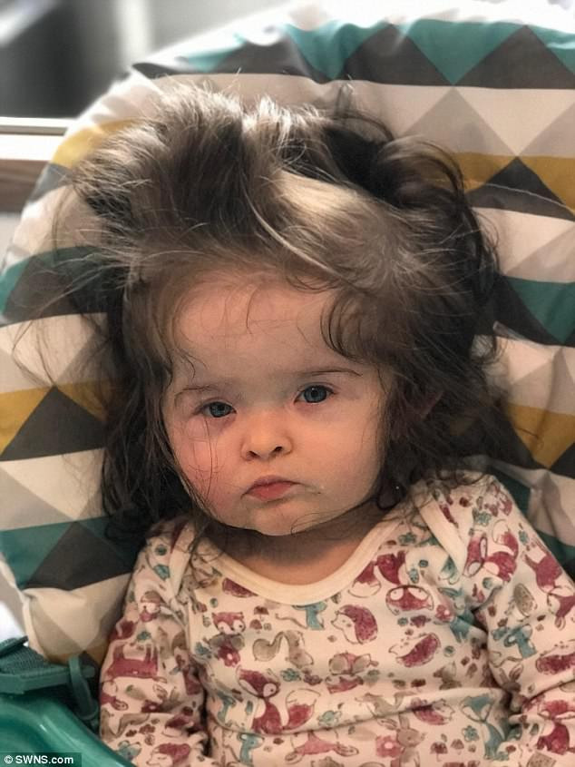 Shaving Baby Hair Good Or Bad
 Devon mother of baby born with long hair reveals her shock